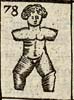Man dismembered